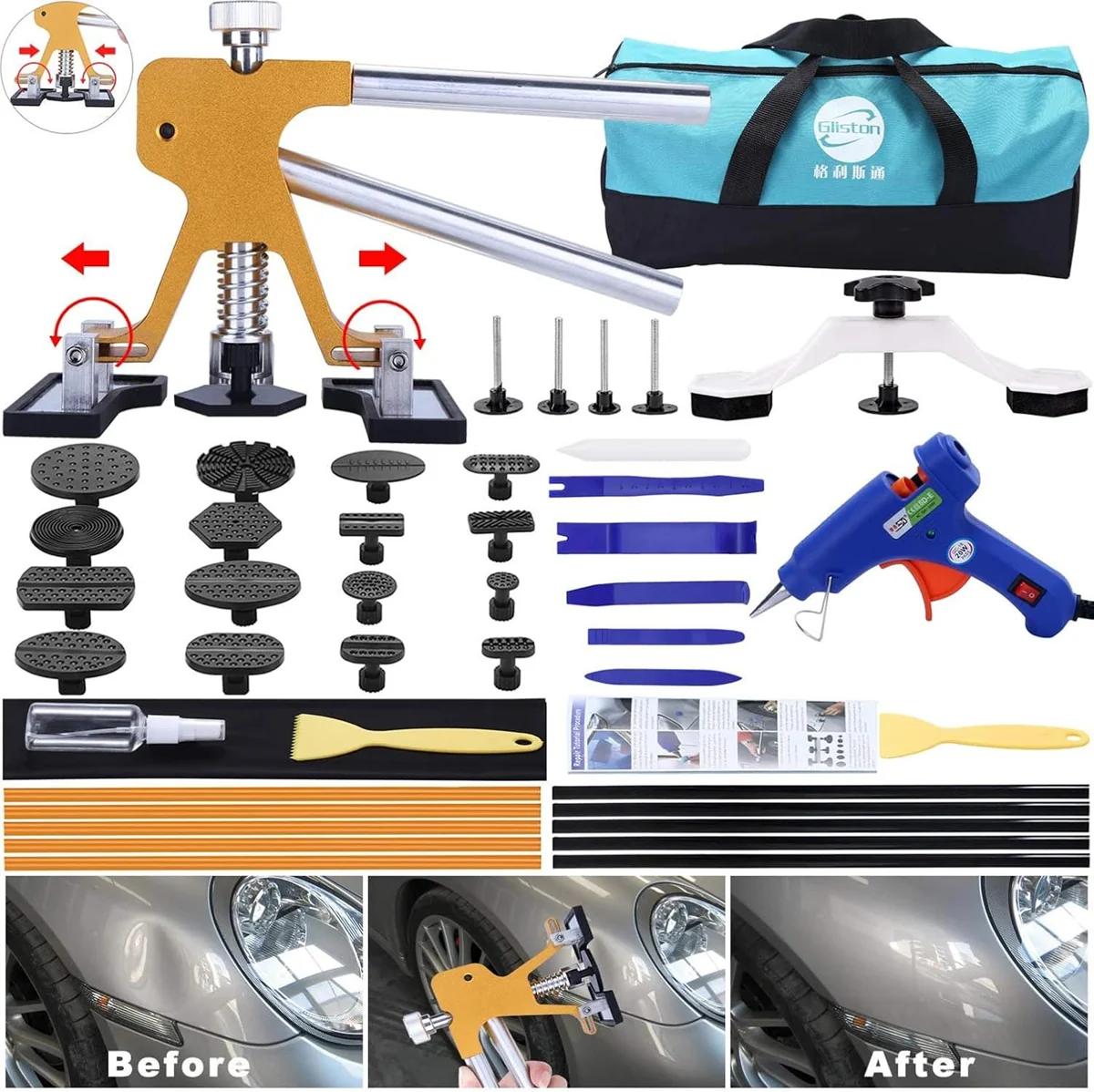 GLISTON Dent Repair Tool Kit